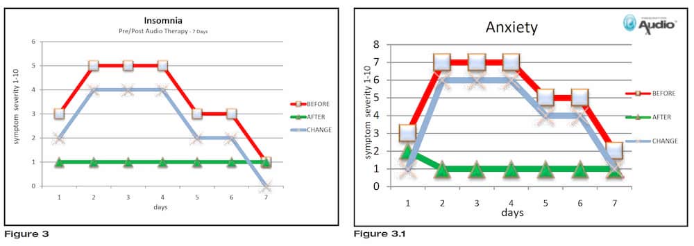 Pre Post Results Using Vibra-Acoustic Therapy UK For Anxiety